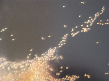 銀河系の☆ではないです。大宇宙のようですが、これは精子くんたち。こんなにたくさんの精子が、卵子ちゃんに向かいます。